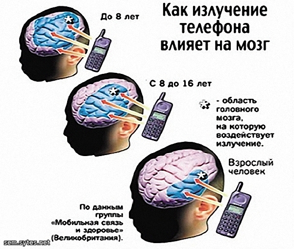 ems-1